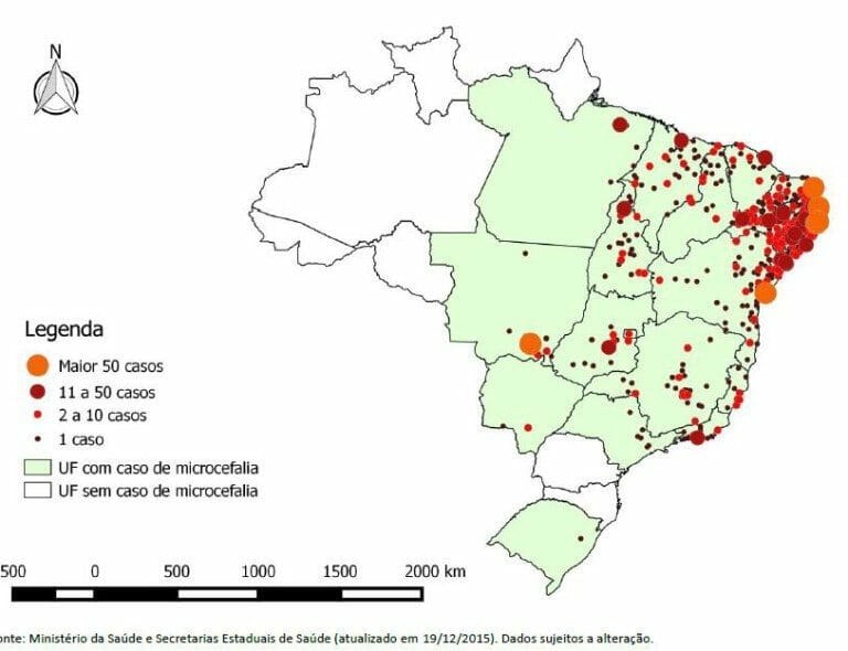 Brazil Microcephaly Zika Virus Scam